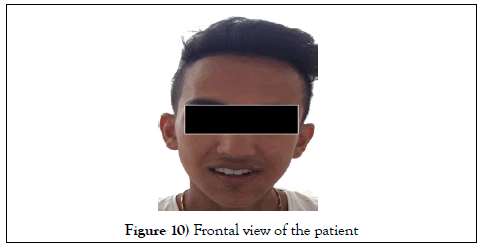 dentistry-case-report-patient