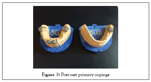 dentistry-case-report-post-cast