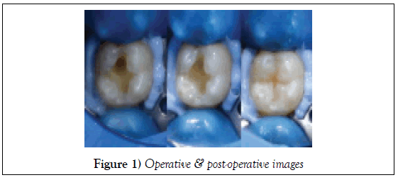 dentistry-case-report-post-operative