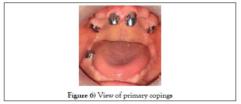 dentistry-case-report-primary