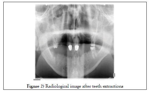 dentistry-case-report-radiological
