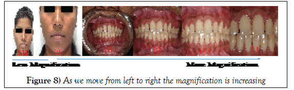 dentistry-case-report-right