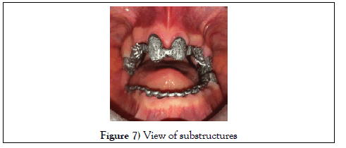 dentistry-case-report-substructures