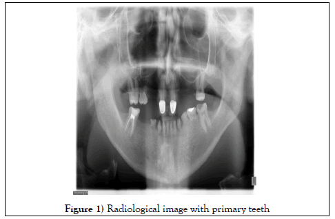 dentistry-case-report-teeth