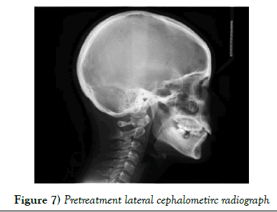 dentistry-cephalometirc-radiograph