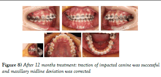 dentistry-months-treatment