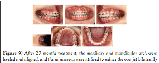 dentistry-months-treatment