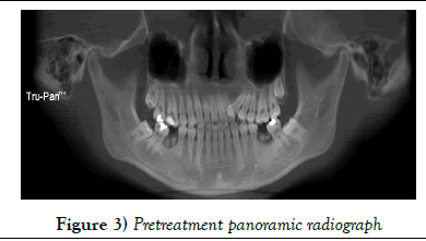 dentistry-panoramic-radiograph