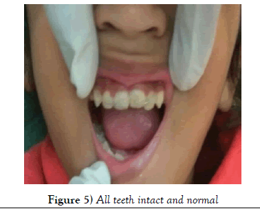 dentistry-teeth-intact