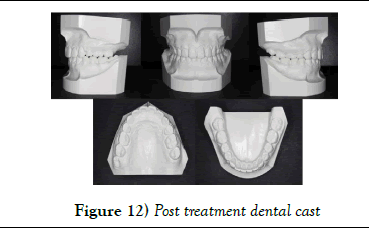 dentistry-treatment-dental