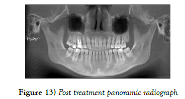 dentistry-treatment-panoramic