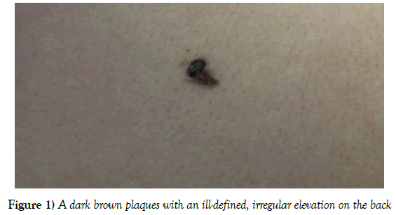 dermatopathology-ill-defined-irregular