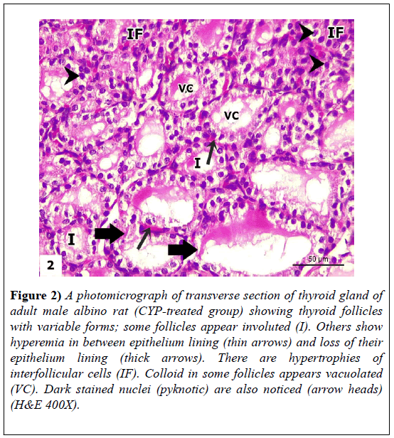 experimental-medicine-biology-thyroid-gland