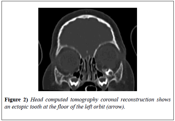 experimental-medicine-tomography-coronal