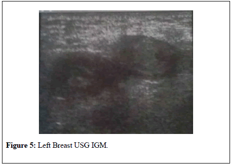 general-surgery-Breast-USG