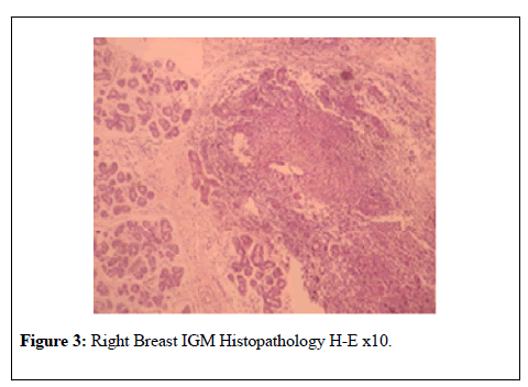 general-surgery-IGM-Histopathology