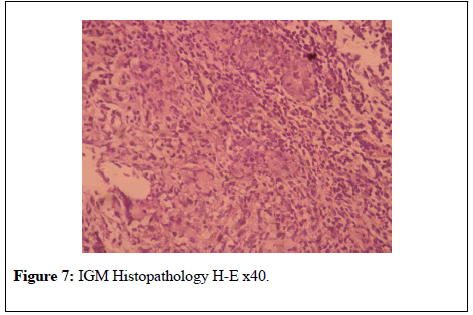 general-surgery-IGM-Histopathology