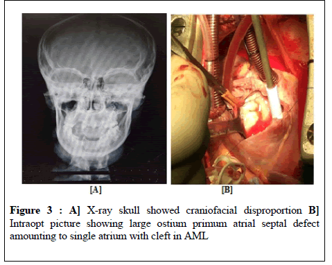general-surgery-craniofacial-disproportion