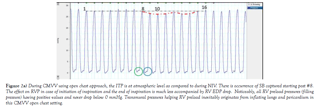 heart-research-chest-approach