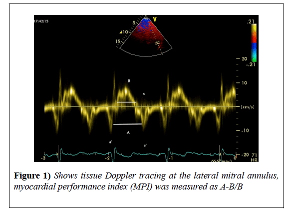 heart-research-lateral-mitral