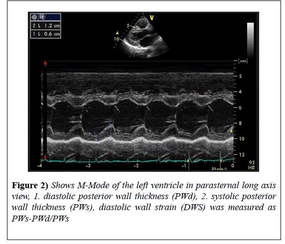 heart-research-long-axis