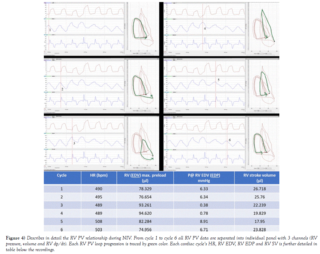 heart-research-loop-progression