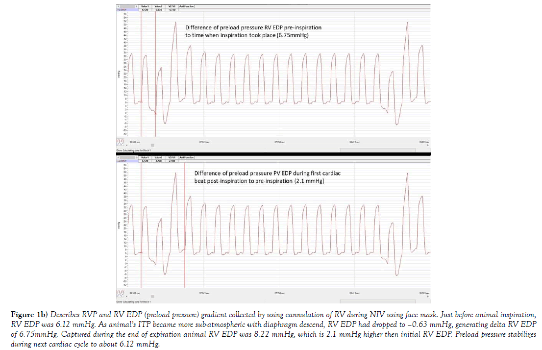 heart-research-preload-pressure
