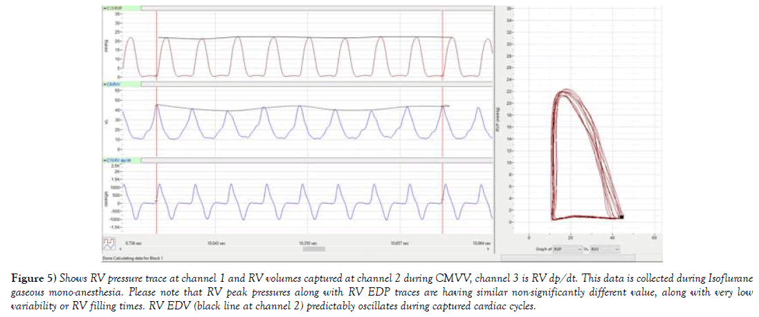 heart-research-pressure-trace