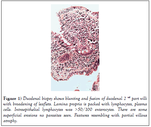 hepatogastroenterology-duodenal-biopsy