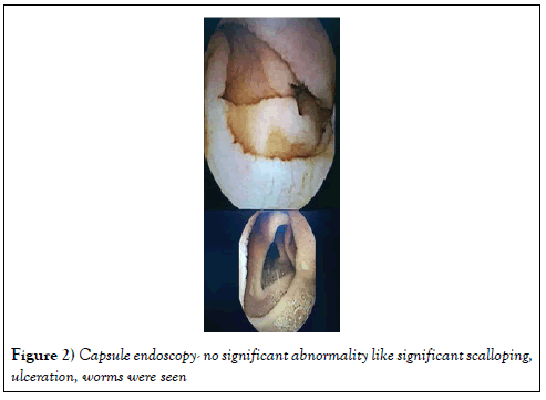 hepatogastroenterology-endoscopy