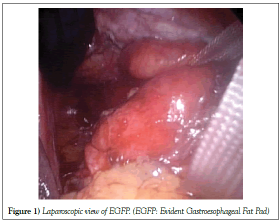 hepatogastroenterology-gastroesophageal