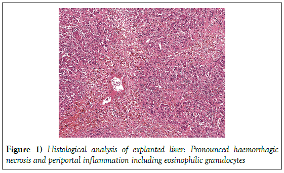 hepatogastroenterology-haemorrhagic