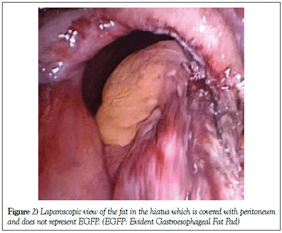 hepatogastroenterology-peritoneum