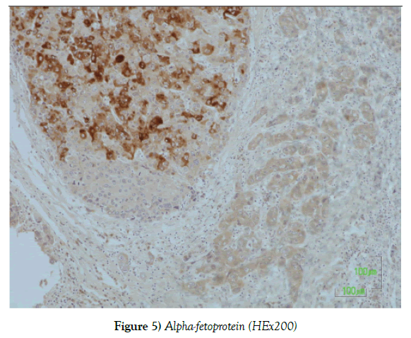 histology-histopathology-research-alpha-fetoprotein