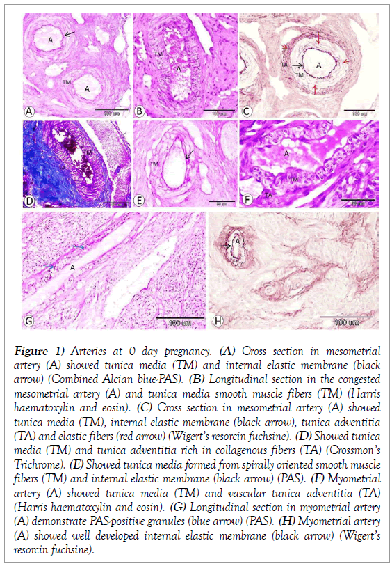 histology-histopathology-research-arteries-pregnancy-mesometrial