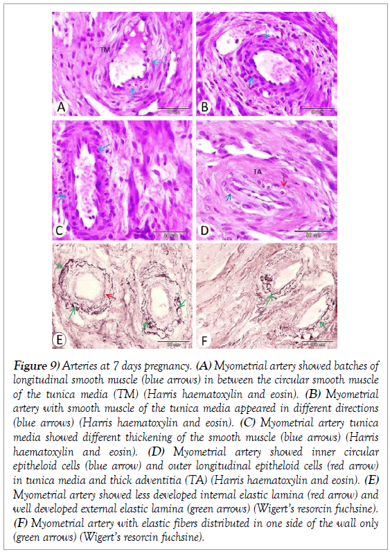 histology-histopathology-research-arteries-pregnancy-myometrial