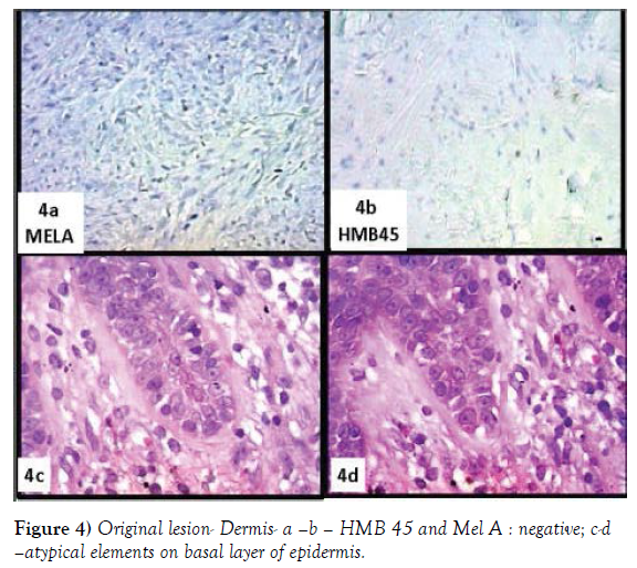 histology-histopathology-research-atypical-elements