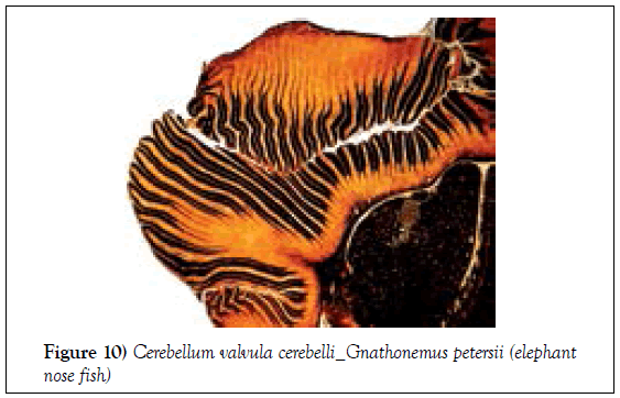 histology-histopathology-research-cerebellum-valvula