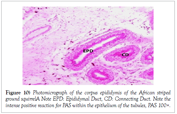 histology-histopathology-research-corpus-epididymis-epithelium