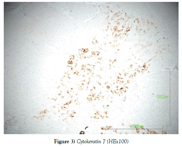 histology-histopathology-research-cytokeratin