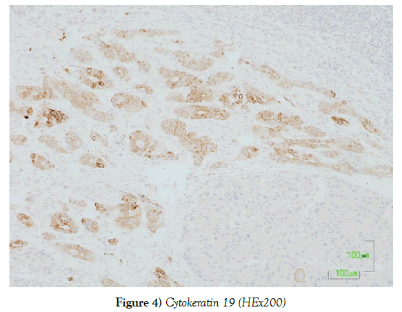 histology-histopathology-research-cytokeratin