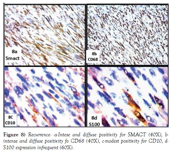 histology-histopathology-research-diffuse-positivity