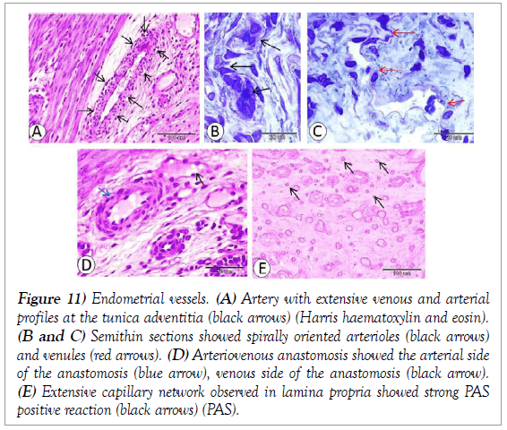 histology-histopathology-research-endometrial-vessels-venous