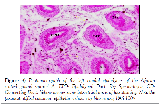 histology-histopathology-research-epididymal-duct-spermatozoa