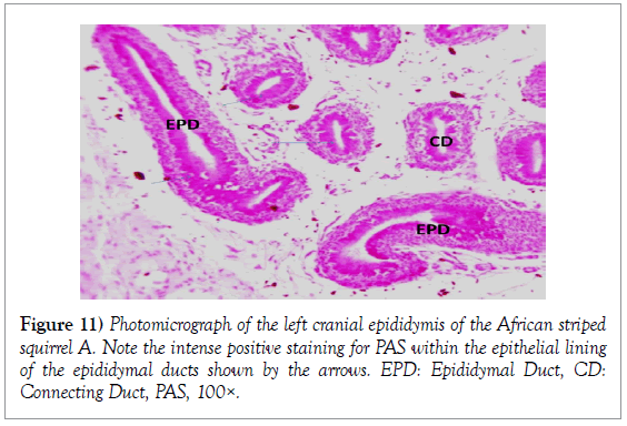 histology-histopathology-research-epithelial-ducts-epididymal