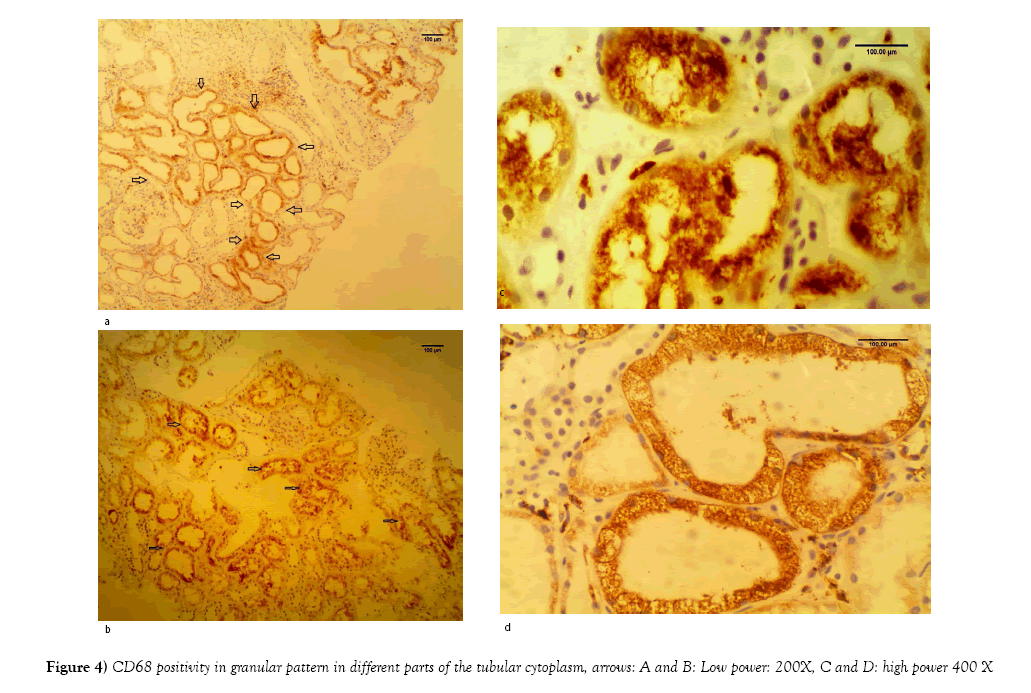 histology-histopathology-research-granular-pattern