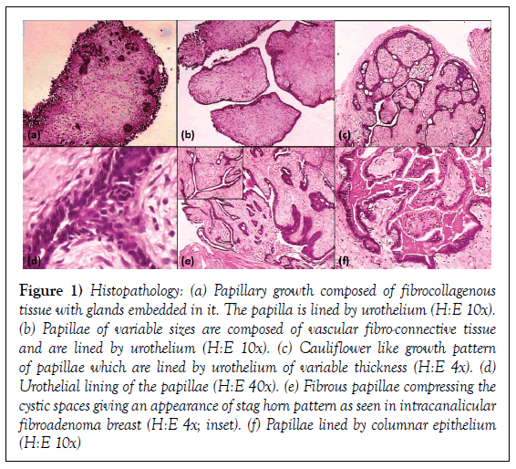 histology-histopathology-research-histopathology-papillary
