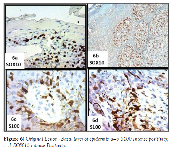 histology-histopathology-research-intense-positivity