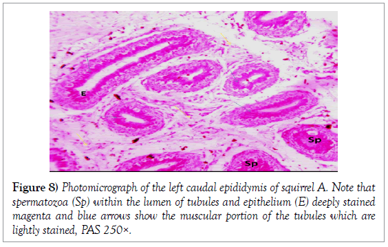 histology-histopathology-research-lumen-tubules-epithelium