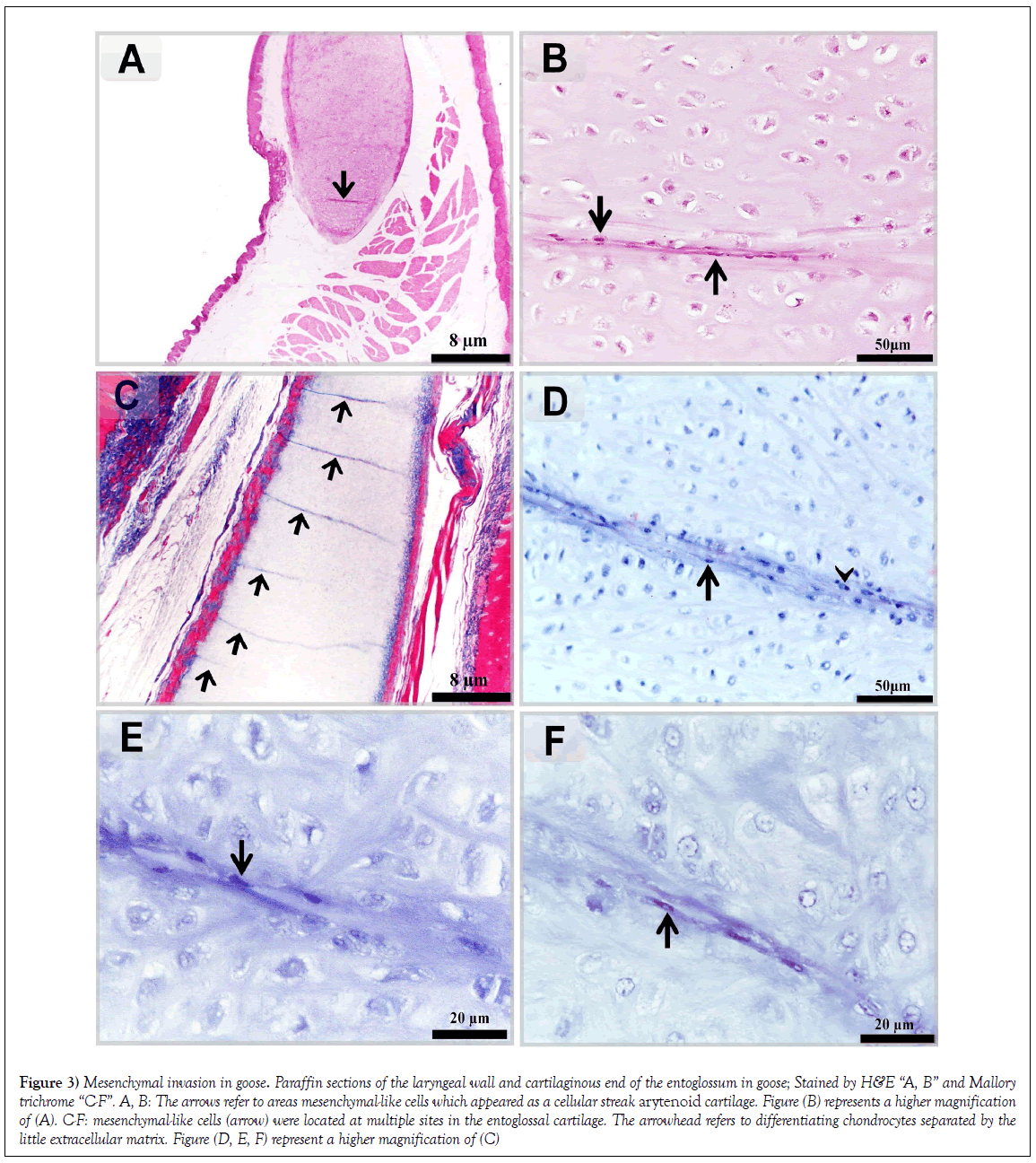 histology-histopathology-research-mesenchymal-invasion-goose